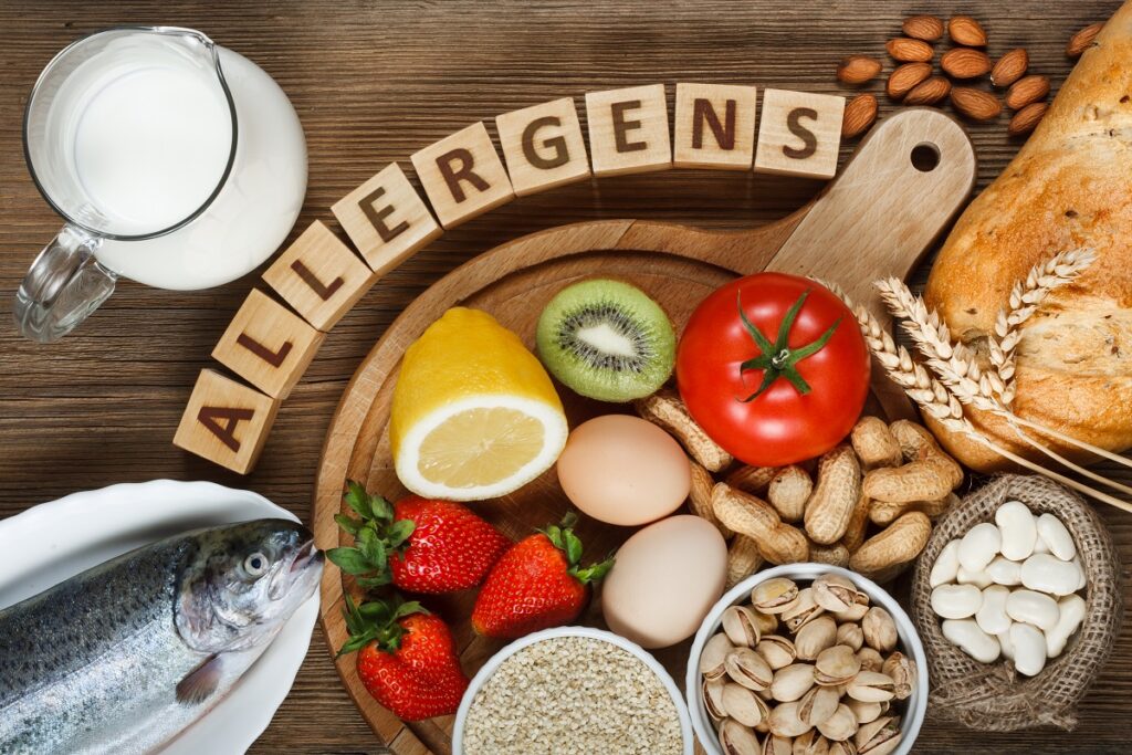 Allergie alimentari Allergie alimentari