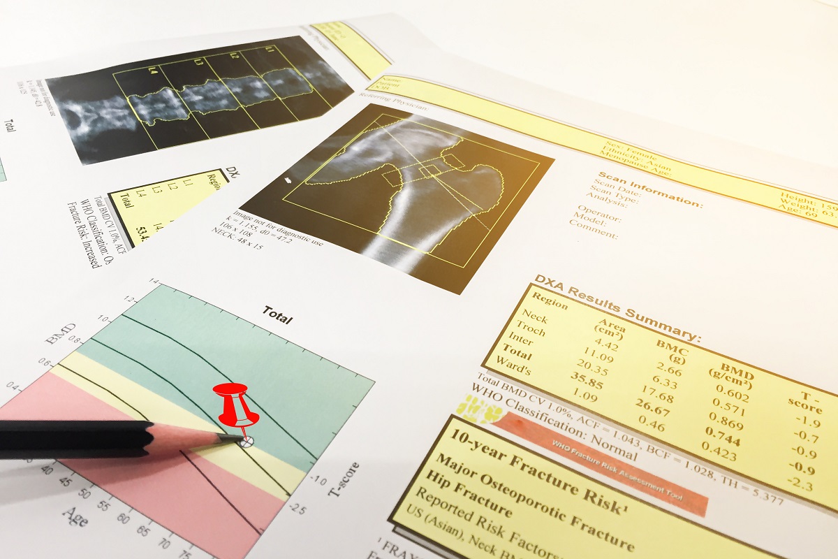 osteoporosi