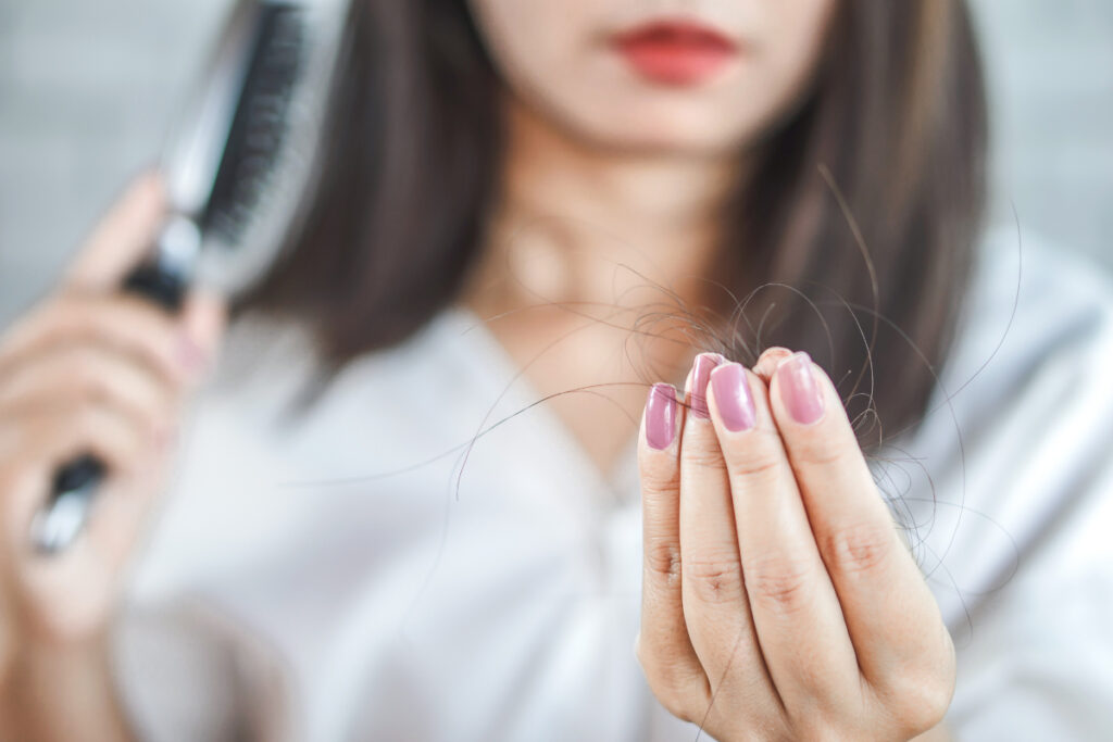 alopecia alopecia
