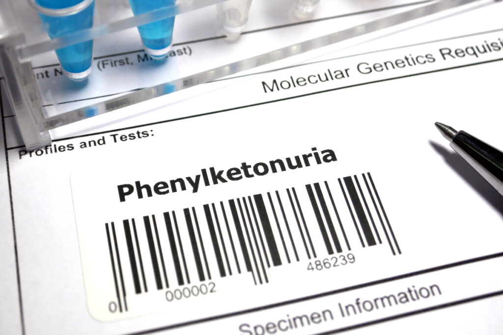 fenilchetonuria fenilchetonuria