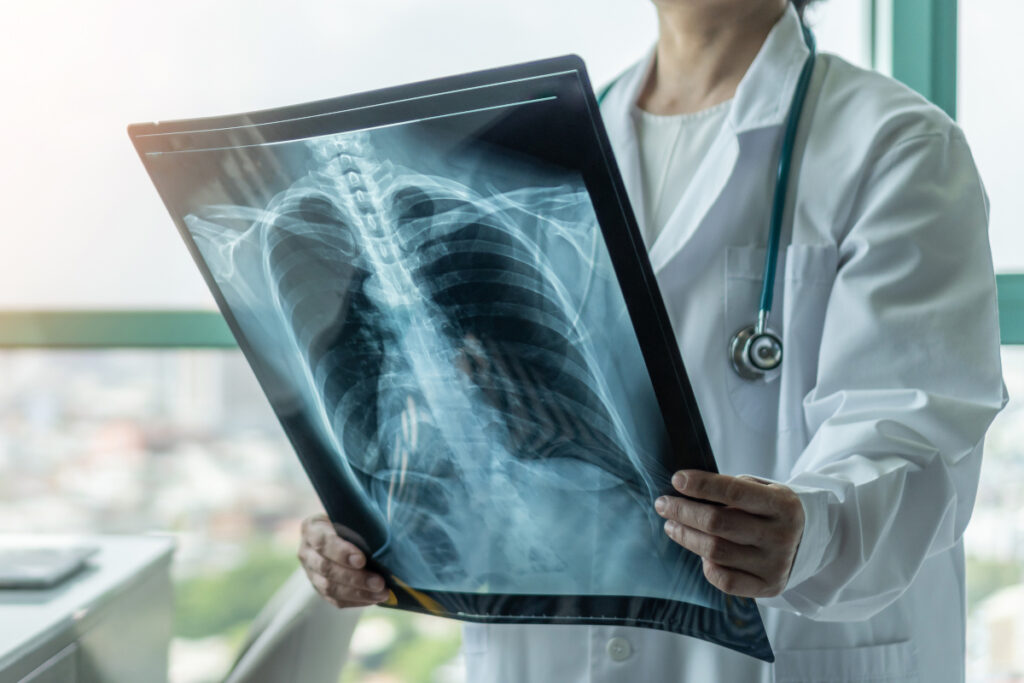 insufficienza-respiratoria-da-pat-app-scheletrico insufficienza-respiratoria-da-pat-app-scheletrico