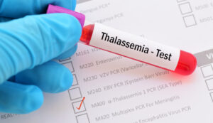 talassemia