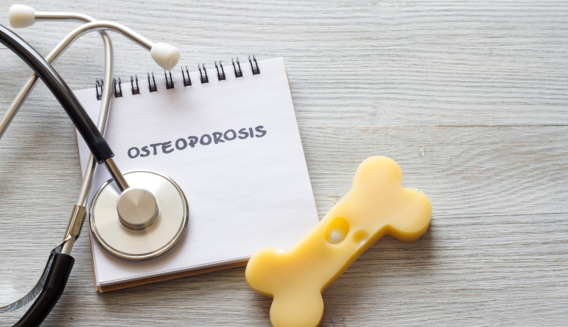 Osteoporosi: diagnosi e gestione