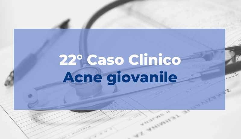 Caso clinico: Acne giovanile