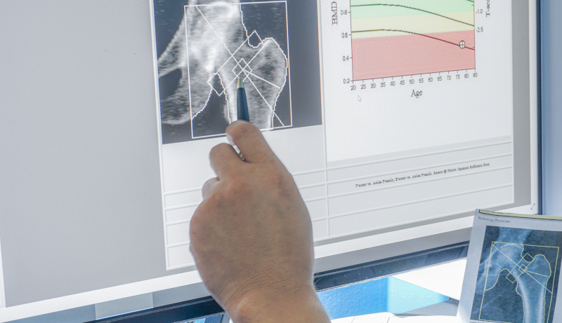 microbiota_osteoporosi