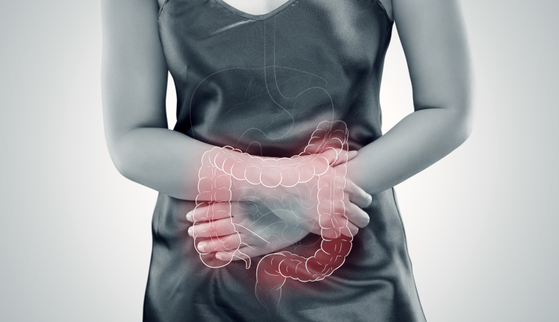 Sindrome dell'intestino irritabile (IBS)