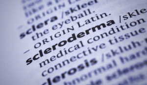 sclerodermia