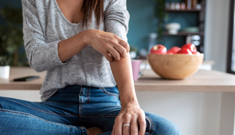 Young woman scratching her arm while sitting on the stool in the home kitchen. dieta-pelle