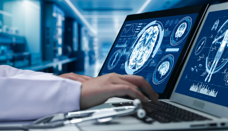 Alimentazione e rischio di Parkinson