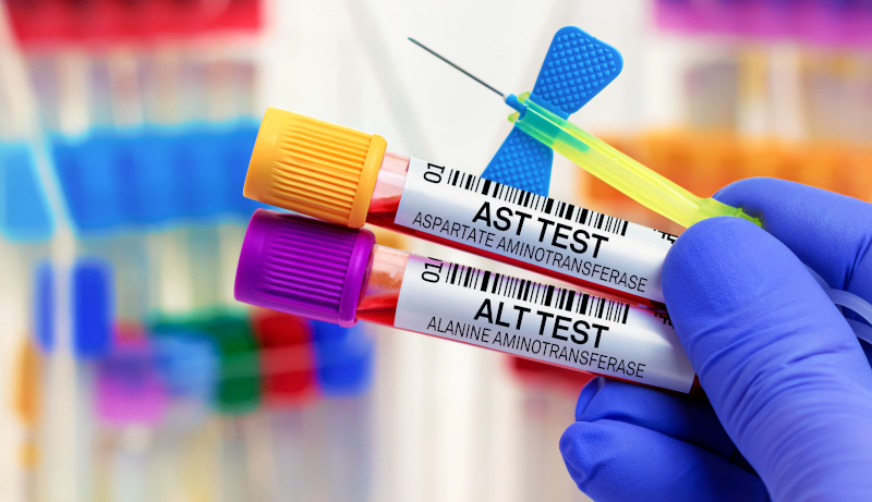 La DASH fa bene anche al fegato