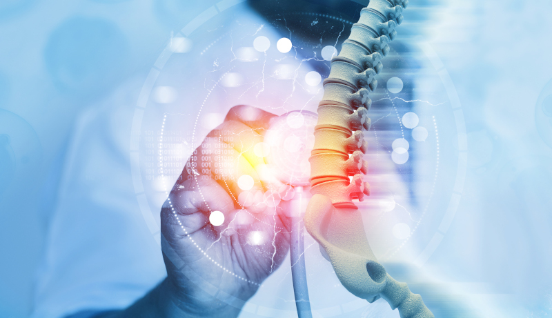 Pediatria: IBD e salute delle ossa