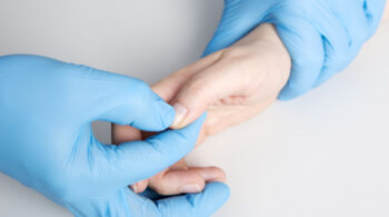 First Aid - doing a Capillary refill test capillari